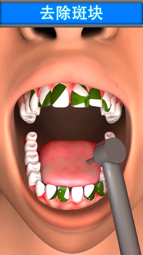 虚拟牙医牙齿童话2